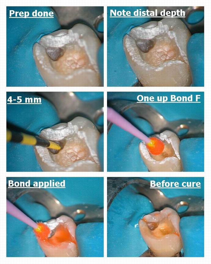 Resize of Occlusal page 2.jpg